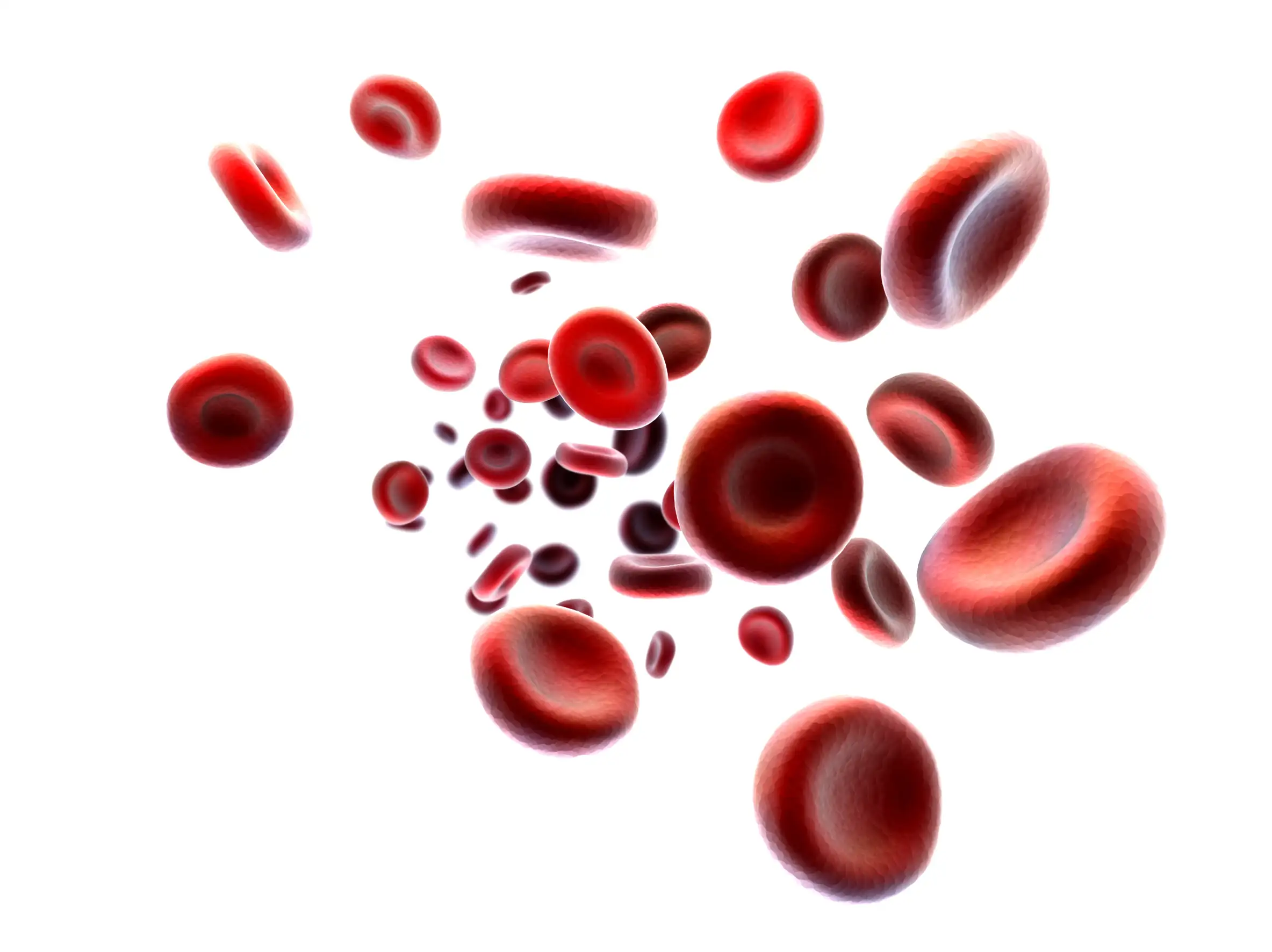 Iron deficiency anemia