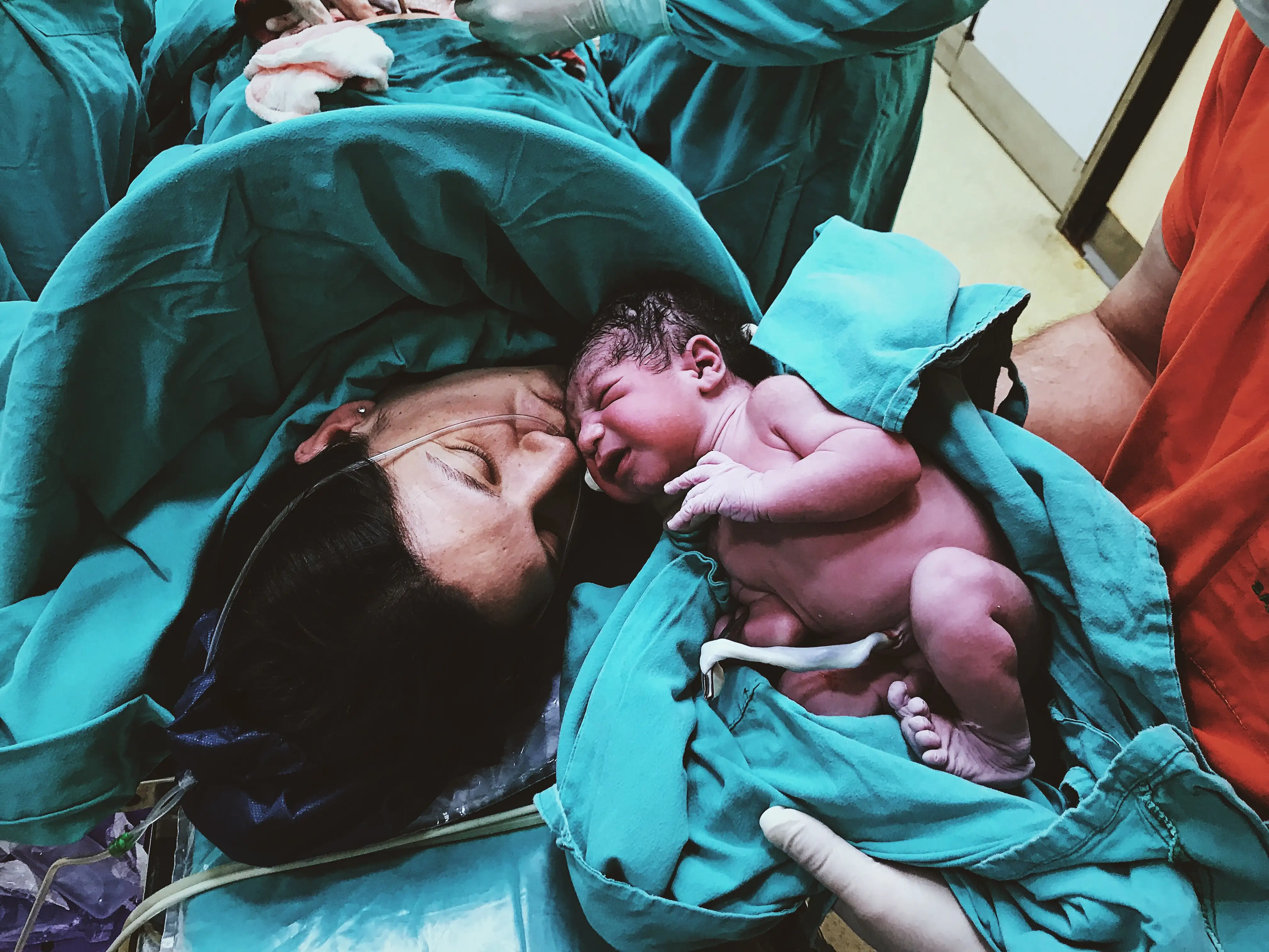 Cesarean delivery