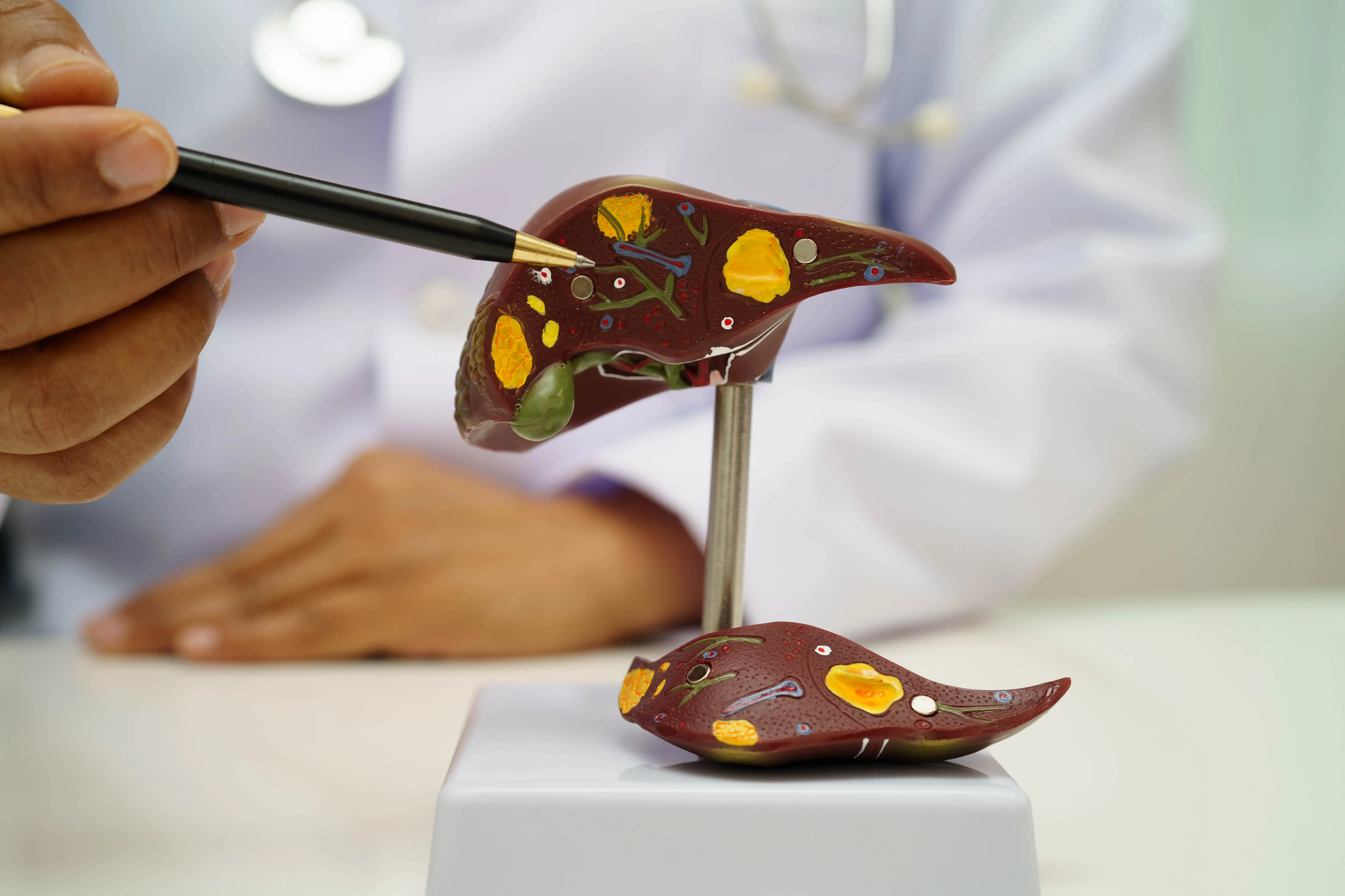 Nonalcoholic fatty liver disease