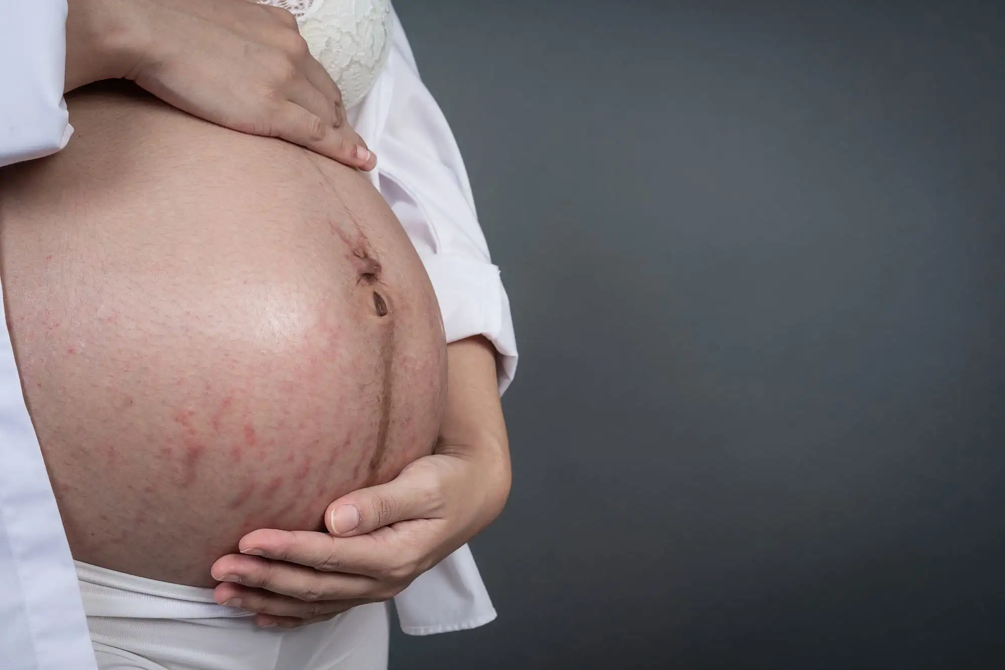 Dermatoses of pregnancy