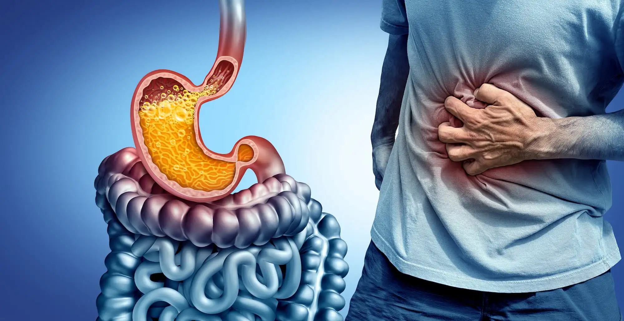 Gastroesophageal reflux disease (GERD)