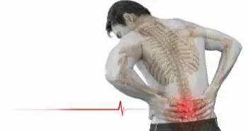 Біль у нижній частині спини: особливості ведення пацієнтів