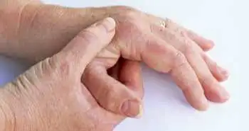 Ефективність тофацитинібу при ревматоїдному артриті залежно від дози супутньої терапії метотрексатом