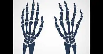 Фактори, що впливають на вибір біологічної терапії першої та другої лінії лікування ревматоїдного артриту