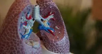 Лекція «Контроль болю при гострих респіраторних інфекціях»