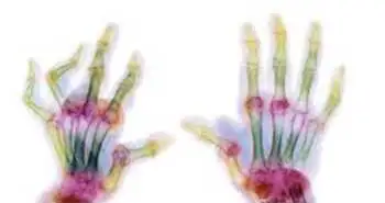 Систематичний огляд та мета-аналіз