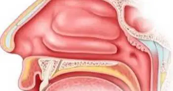 Алергологія: дифдіагностика алергічного та неалергічного риніту