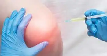 Дослідження ін’єкцій розчину аутологічних білків для лікування остеоартриту колінних суглобів