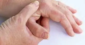Дослідження ефективності шин при остеоартриті основи великого пальця кисті