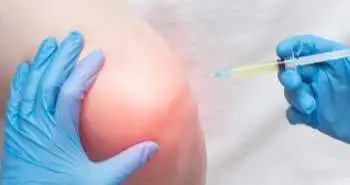 Хімічна абляция колінного нерва фенолом - ефективний і безпечний метод лікування остеоартриту колінного суглоба