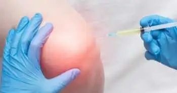 Ефективність та безпечність одноразової внутрішньосуглобової ін'єкції поперечно-зшитої гіалуронової кислоти і збагаченої тромбоцитами плазми в порівнянні з збагаченою тромбоцитами плазмою в якості монотерапії при лікуванні остеоартрозу колінного суглоба