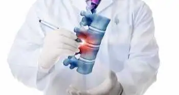 Умовний стимул при відкритому застосуванні плацебо для зниження споживання опіоїдів у пацієнтів після хірургічних втручань на хребті