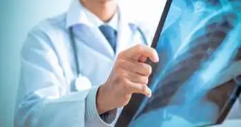 Оцінка діагностичної ефективності КТ грудної клітки для виявлення коронавірусної інфекції SARS-CoV-2 незалежно від наявності клінічних проявів захворювання