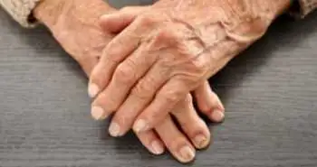 Ефективність лікування пефіцитинібом ревматоїдного артриту утримувалася протягом подовженого дослідження