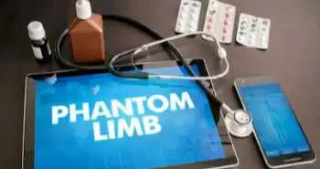 Подовжена периферична нервова блокада в амбулаторних умовах зменшує біль після ампутації кінцівки