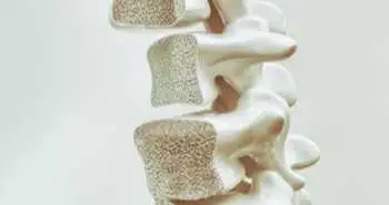 Чи є остеопороз незалежним фактором ризику пародонтозу?