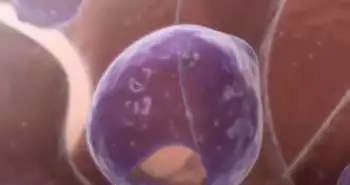 Ліпосомальне залізо для вагітних - комплекс Ферровью