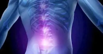 Блокада м'яза, що випрямляє хребет, полегшує біль після хірургічного лікування грижі поперекового відділу