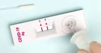 Оцінка п'яти експрес-тестів на антиген COVID-19 в стаціонарі і вивчення продуктивності одного тесту на антиген в клінічній практиці