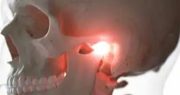 Оцінка ефективності застосування аутологічної плазми, збагаченої тромбоцитами, в порівнянні з хітозаном в лікуванні остеоартрозу скронево-нижньощелепного суглоба