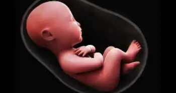 Зв'язок синдрому чутливого сечового міхура з вагітністю та наслідками у новонароджених