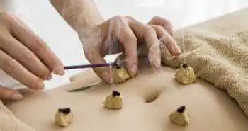 Аналгетична ефективність моксібустіона у пацієнток з первинною дисменореєю