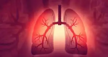Терапія нінтеданібом здатна знизити ступінь ураження легень, спричиненого COVID-19