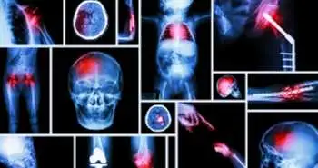 Біль та запалення