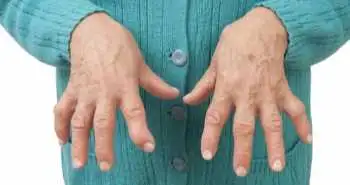 теноксикаму