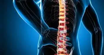 Клінічні особливості остеoхондрозу хребта