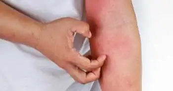 коронавірус