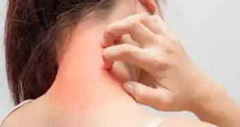 дерматологія