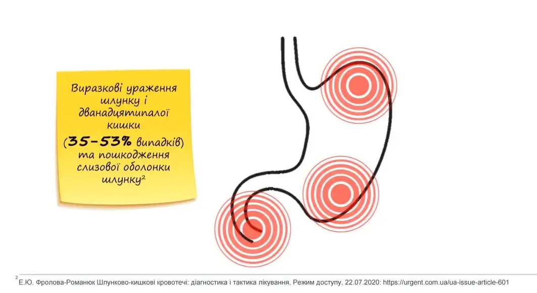 нпзп, гастропатія