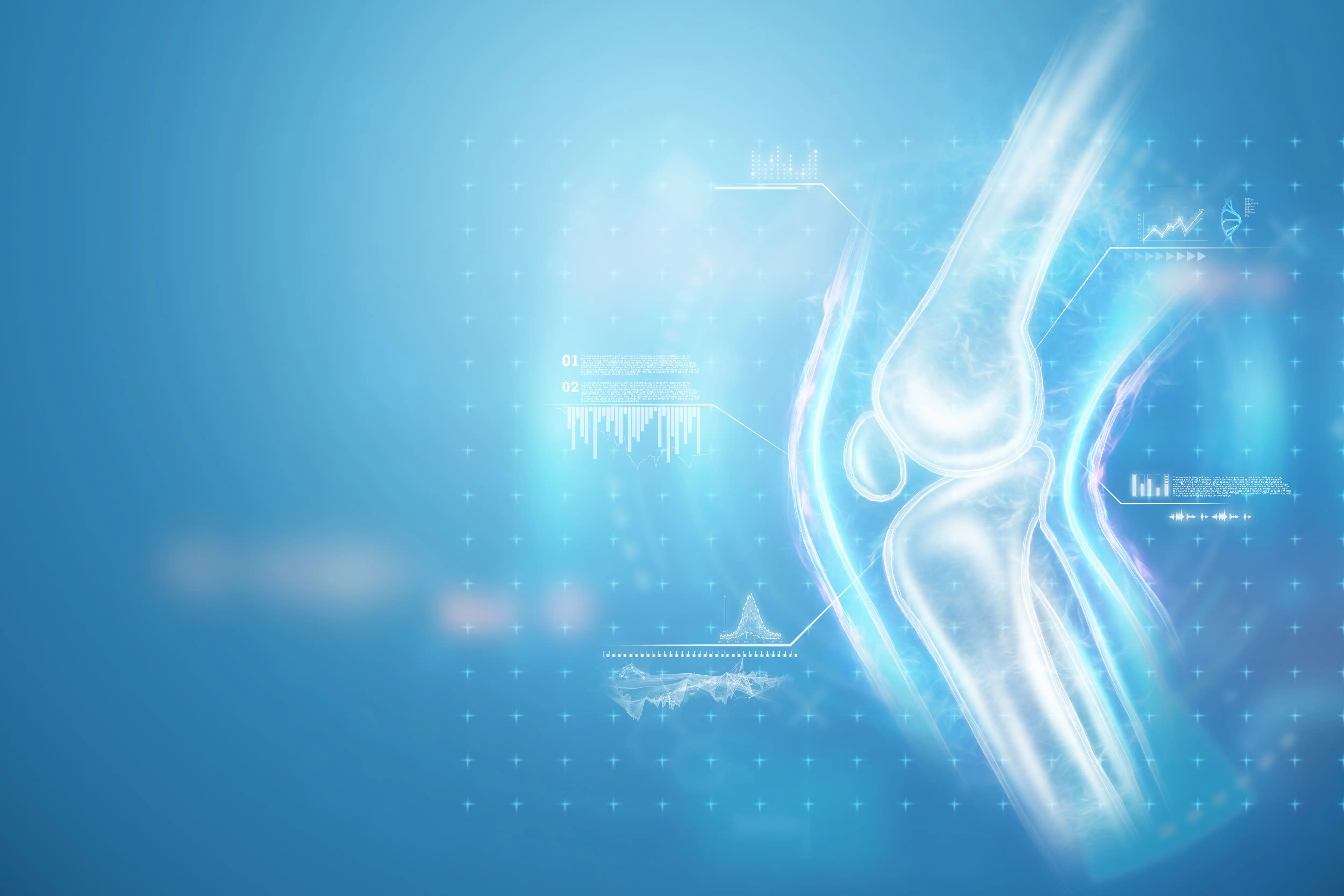 остеоартроз колінного суглоба