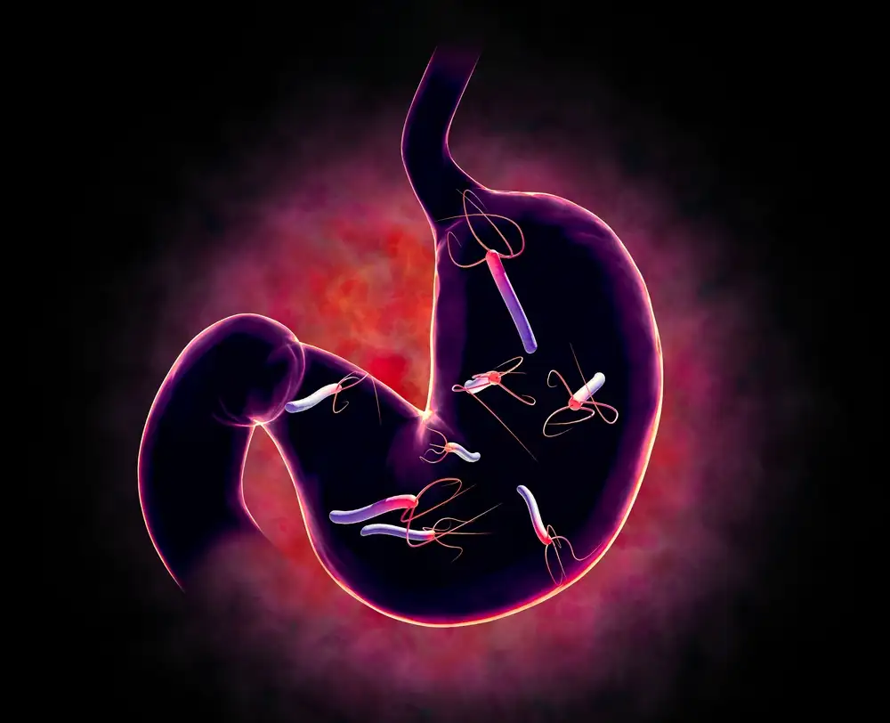 інфекція H. pylori