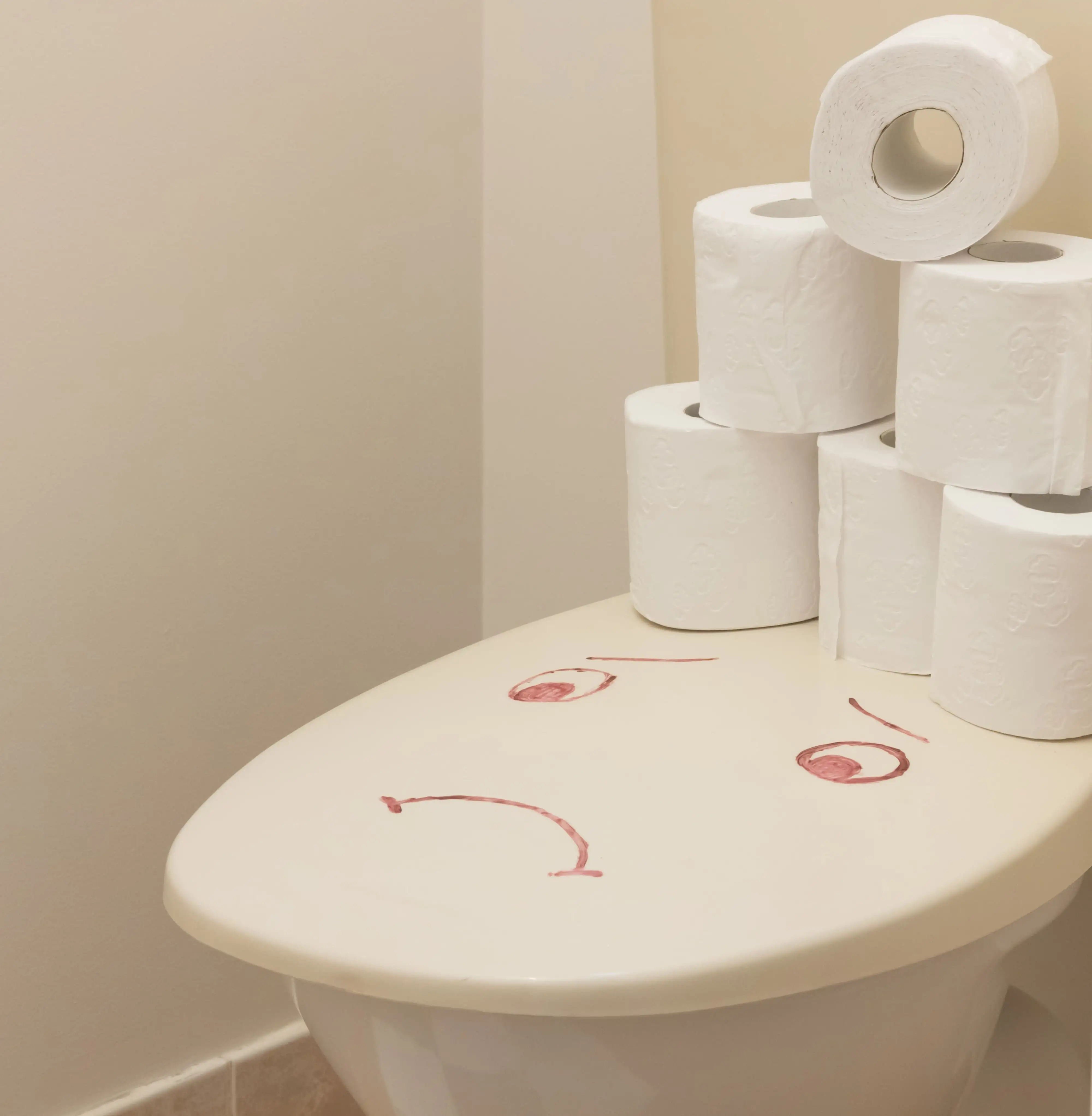 хронічний запор